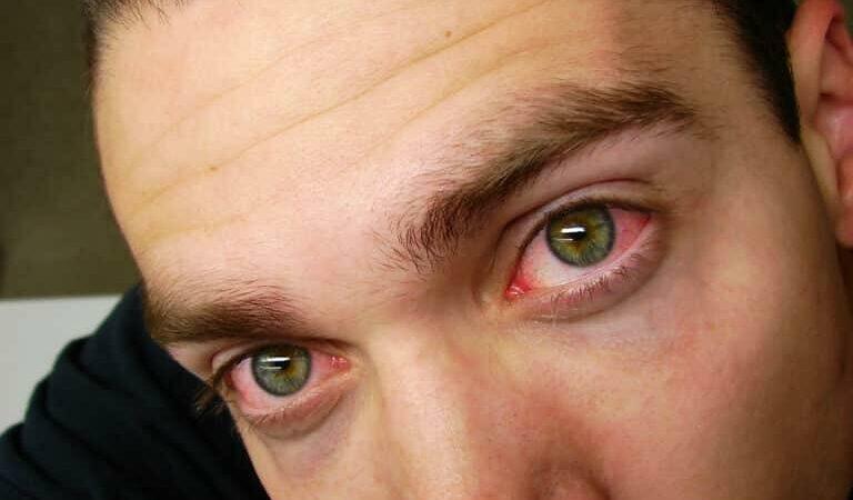 Weed Eyes: Why Does Weed Make Your Eyes Red and Mouth Dry?